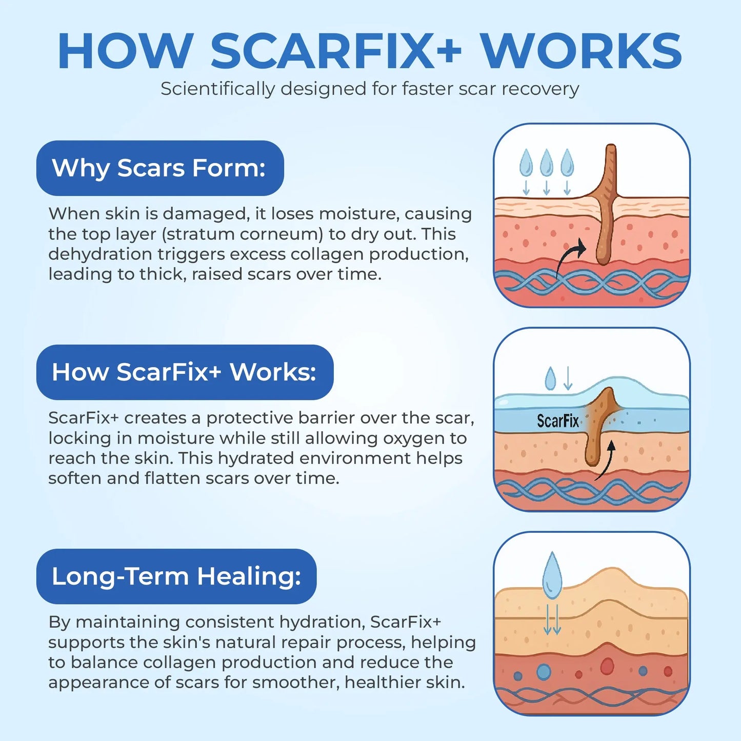 ScarFix+ | Transparent Silicone Scar Plasters for Surgery, Acne & Stretch Marks My Store