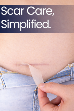 ScarFix+ | Transparent Silicone Scar Plasters for Surgery, Acne & Stretch Marks My Store