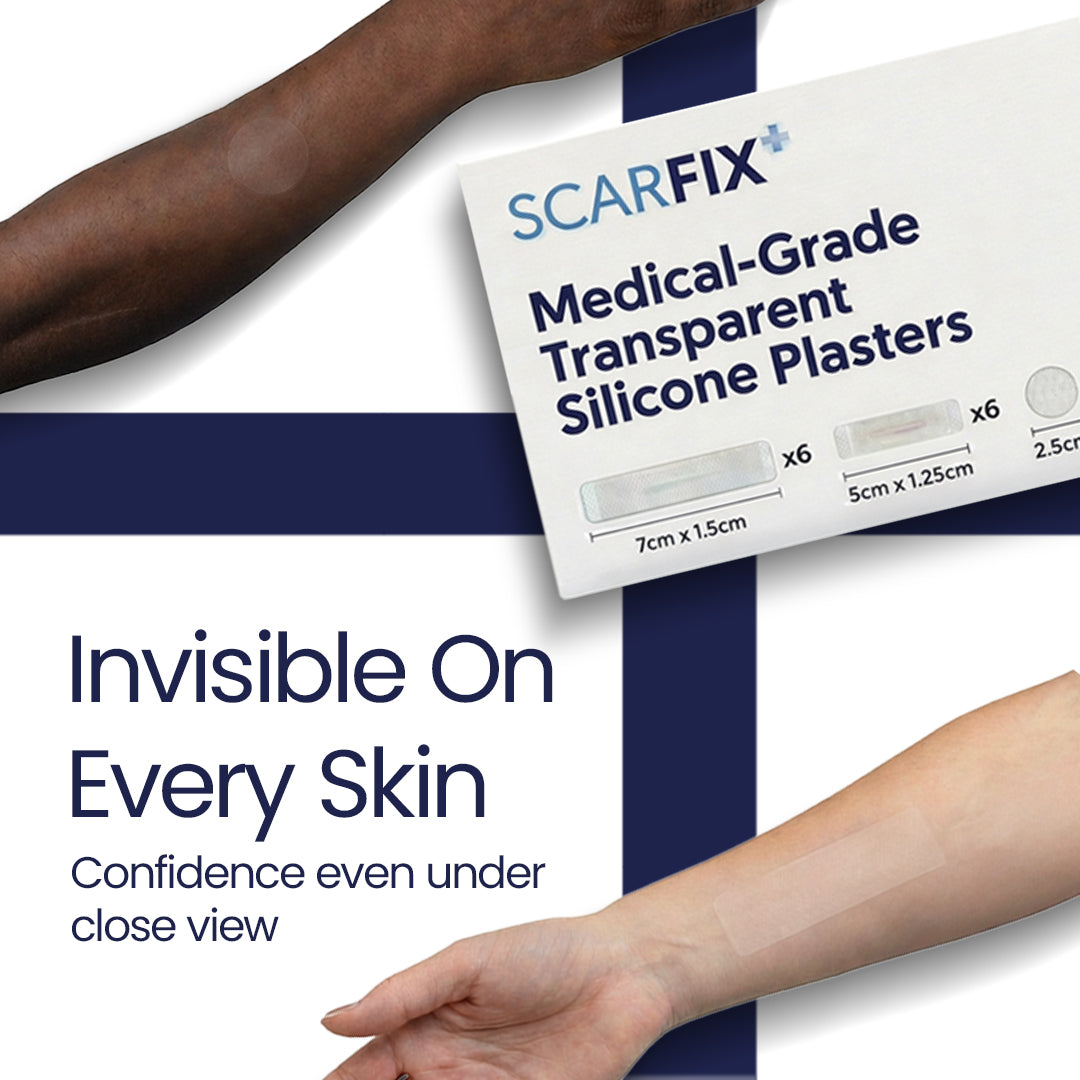 ScarFix+ | Transparent Silicone Scar Plasters for Surgery, Acne & Stretch Marks My Store