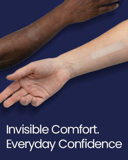 ScarFix+ | Transparent Silicone Scar Plasters for Surgery, Acne & Stretch Marks My Store