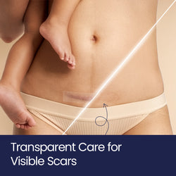 ScarFix+ | Transparent Silicone Scar Plasters for Surgery, Acne & Stretch Marks My Store