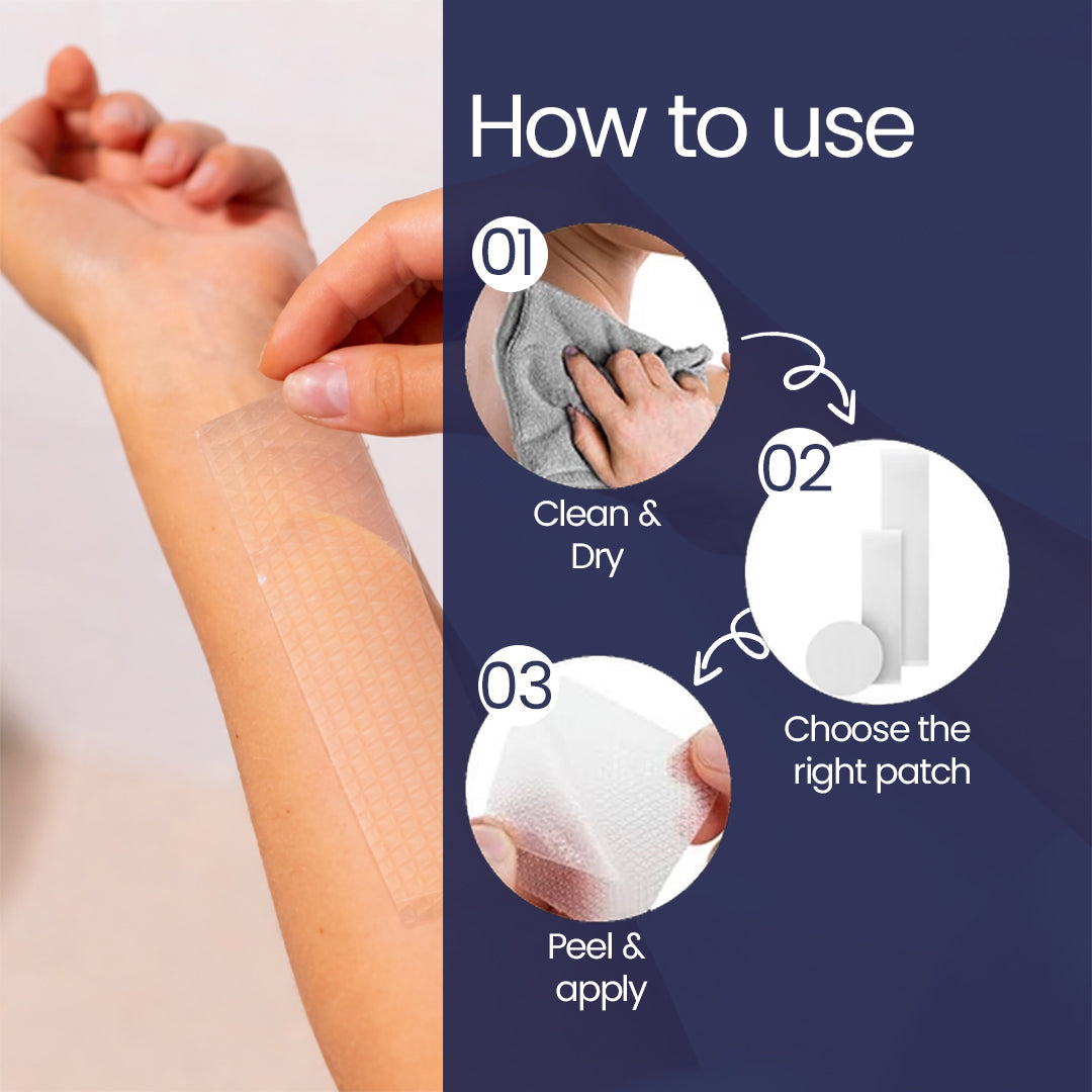 ScarFix+ | Transparent Silicone Scar Plasters for Surgery, Acne & Stretch Marks My Store