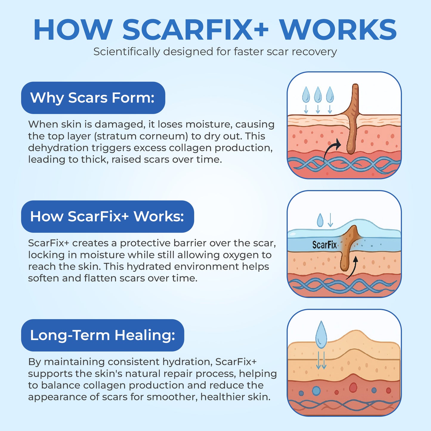 ScarFix+ | Transparent Silicone Scar Plasters for Surgery, Acne & Stretch Marks
